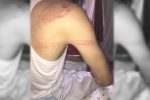 Young Man Detained and Tortured by the Taliban in Kandahar   